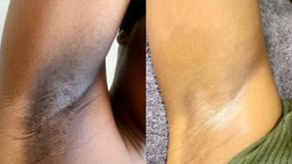 Top Waxing Trends in Midrand: What to Know in 2025